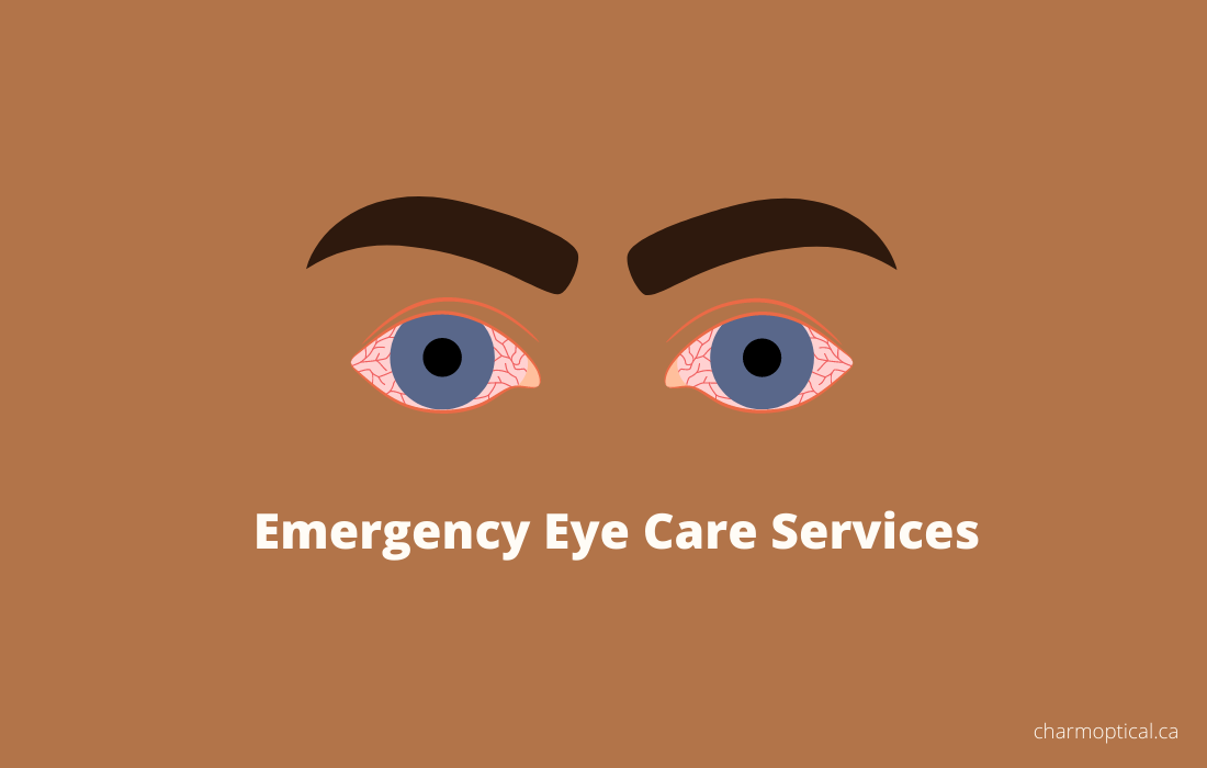 Emergency eye care services in Edmonton-Eye Exam