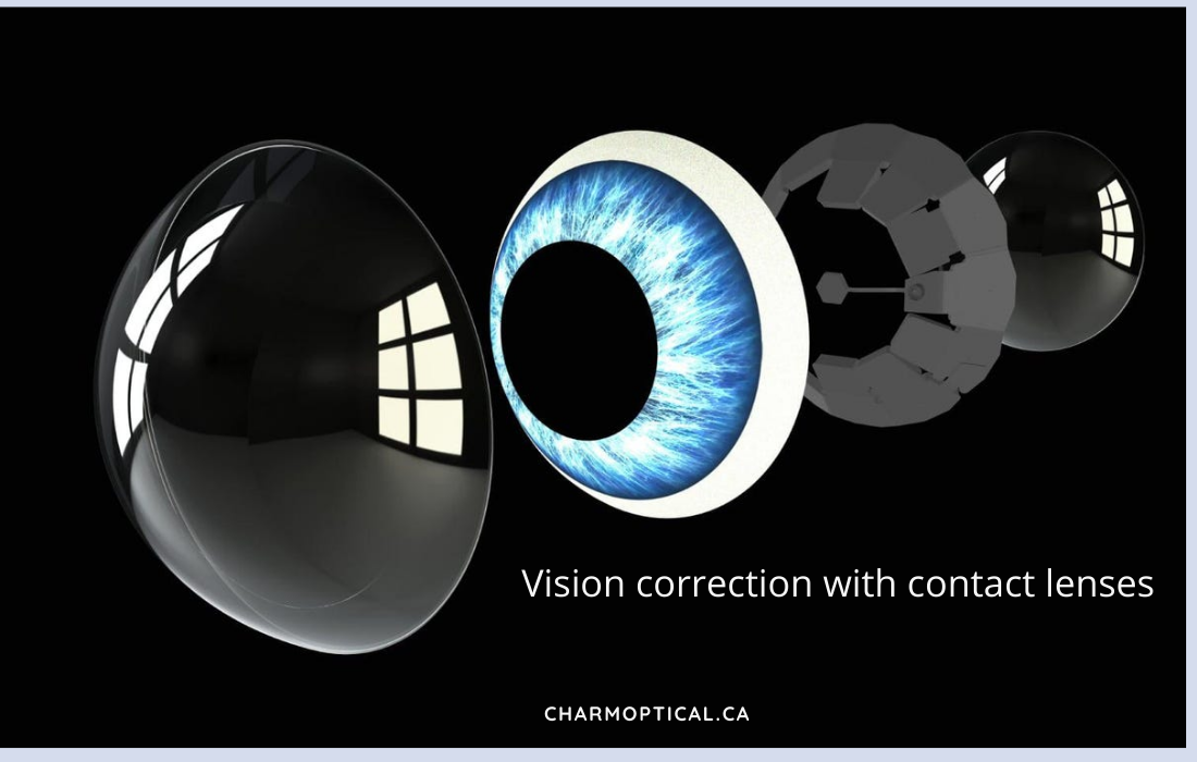Benefits of Vision Correction with Contact Lenses